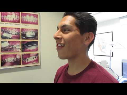 Miguel's new smile!!! Handsome young man ready to eat whatever he wants without braces!