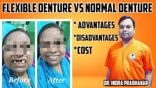 #Flexible#denture vs Normal#Acrylic#denture,#Advantages, disadv.#Cost #Dental#transformation#video,