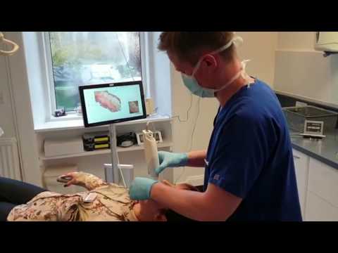 Intraoral Scanner