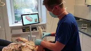 Intraoral Scanner