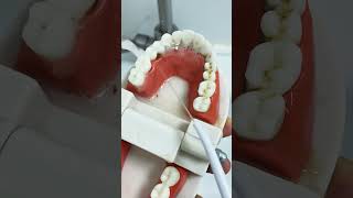 Achieve a Healthy Smile with Portable Dental Care #healthysmile #waterflosser
