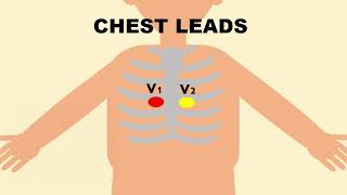 D4A  ECG Clinical Application