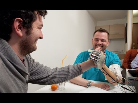 Bionic Hand Allows Amputee to Feel