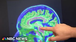 Study finds brain training games may help protect against dementia