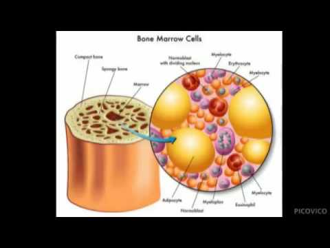 Bone Marrow transpalnt