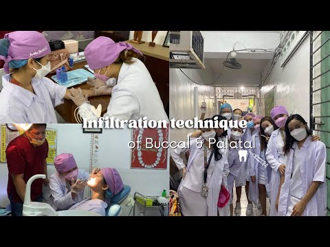 INFILTRATION TECHNIQUE OF BUCCAL AND PALATAL + SKIN TESTING🦷✨  | Russmin Alicando