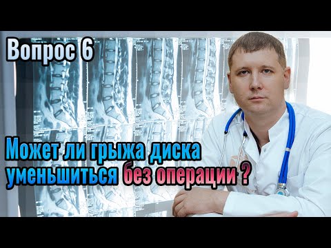 Вопрос 6: может ли грыжа диска уменьшиться без операции?