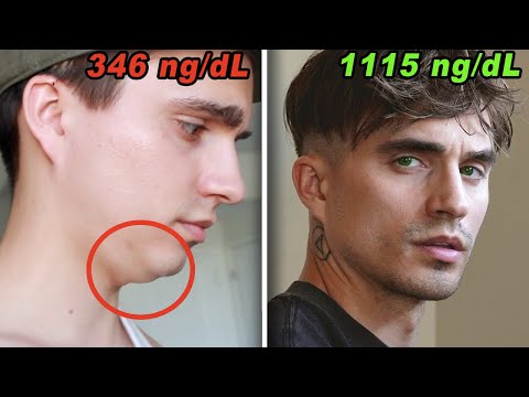 7 BIZARRE Signs You’re LOW In Testosterone