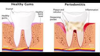 Listen early. Treat early. 🦷#DentalEducation #CalmVoiceover #ToothPain #OralHealth