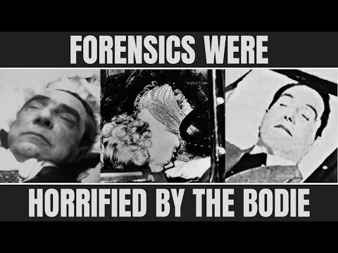 Chilling Autopsy Findings of 15 Classic Hollywood Stars