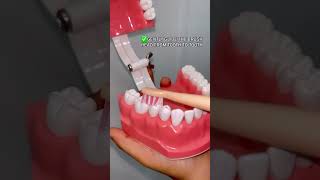 What is the right technique while brushing with an Electric Toothbrush? | ORACURA  #oralcare