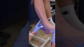 How do you heal a sprained ankle? #rehabilitation #recovery #physicaltherapy