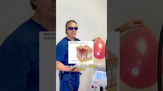 Laser vs Redness --What ACTUALLY Happens in Real Time! #lasertreatment #rosacea