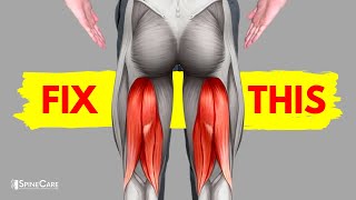 How to Fix a Tight Hamstring for Good
