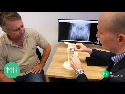Do I need a hip replacement?