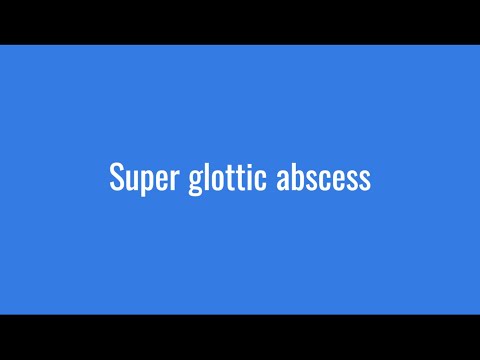 Super Glottic Abscess