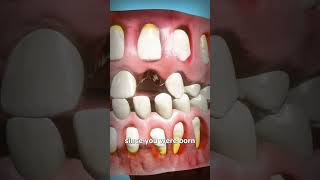 How Adult Teeth Grow In 🤔