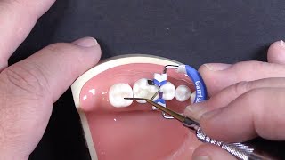 Quick Tip #3 | Rolling the Marginal Ridge