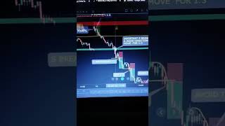 Nifty live option buying trades #nifty #niftylivetradingtoday #nse #chartpattern  #optionstrading