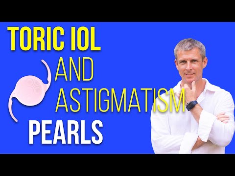 Toric IOLs and astigmatism perls for cataract surgery