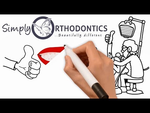 Starting Orthodontic Treatment:   Caring for Braces