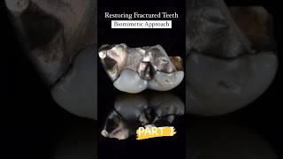 🦷✨ Restoring Fractured Teeth with a Biomimetic Approach! 🌟