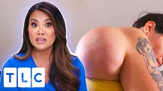 Dr Lee Shocked By This Woman's "THIRD BOOB?!" | Dr. Pimple Popper