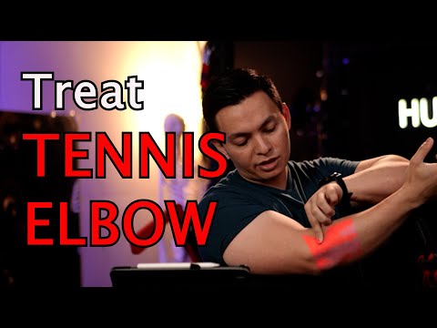 Tennis Elbow: Comprehensive guide from a Physical Therapist