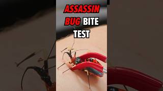 Bitten by an Assassin Bug! Ouch!