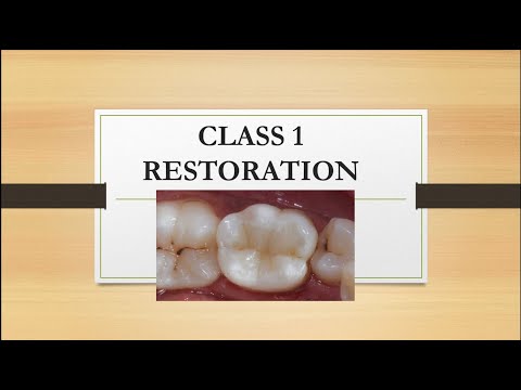 CLASS 1 RESTORATION (COMPOSITE FILLING) ❤️👌