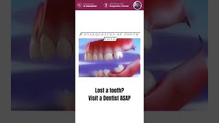 🦷😱 Lost a tooth? Don't panic, act now! Immediate attention from a dentist is crucial