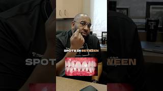 Dentist Shares TOP Flossing Tips