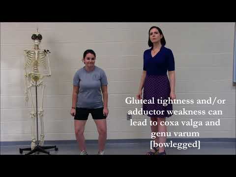 Clinical Correlation - Varus and Valgus and the Physical Exam CORRECTED