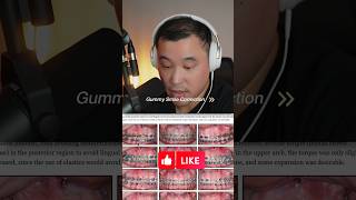 Gummy Smile Correction!! #orthodontics #dentistry