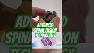 ADVANCED Spinal Fusion Cage