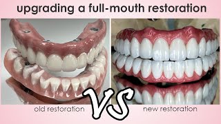 Replacing a Screw-Retained Restoration with a Futuristic Full-Mouth Solution