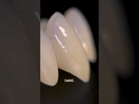4Y Zirconia: The Material That’s Gaining Ground