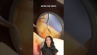 what’s happening at your teeth cleaning appointment? #shorts