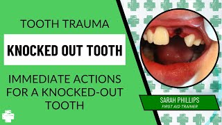 Knocked Out Tooth - Immediate actions for a knocked out tooth