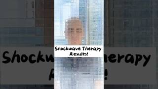 SHOCKWAVE RESULTS | CHRONIC PELVIC PAIN SYNDROME #cpps #malepelvicpain #prostatitis