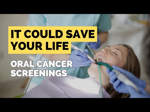 Why You Should NEVER Miss An Oral Cancer Screenings
