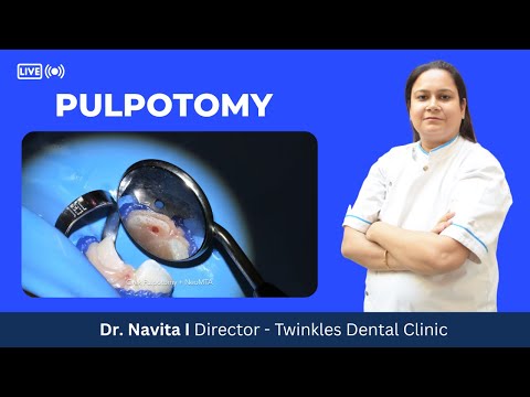Pulpotomy kya hai? I Pulpotomy kab ki jati hai? I Dr. Navita Sharma