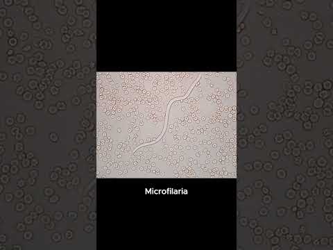 Microfilaria     #Microfilaria