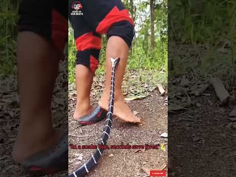 "Snake Bite? Do THIS in 15 Seconds to Save Your Life" #viral #trending #snake