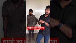 The color of the skin has changed #popatbhai_charitable_foundation #Teampcf #popatbhai_ahir