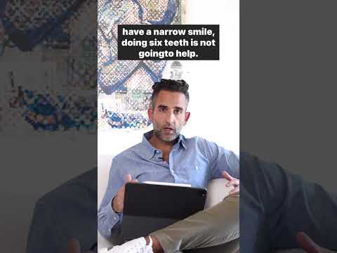 How many teeth will need to be fixed before getting Veneers?