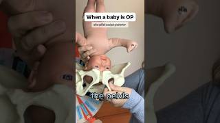 OP baby position (sunny side up) #birth