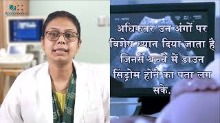 NT NB scan | Ultrasound | #pregnancy  Test | Nuchal Translucency Scan | Apollo Hospital Lucknow