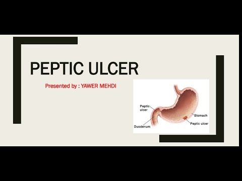 Peptic ulcer disease