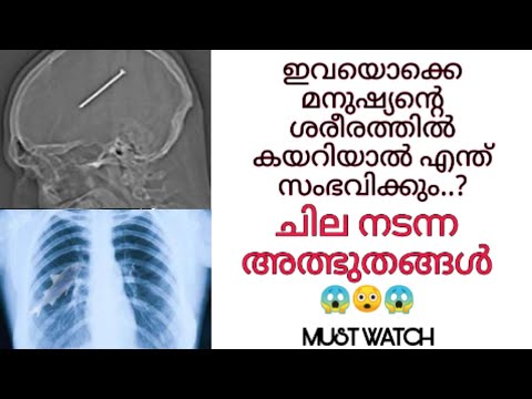 ഇതൊക്കെ മനുഷ്യ ശരീരത്തിൽ 😱 കയറിയാൽ 😳  എന്ത് സംഭവിക്കും..#Mistry #miracle #biology